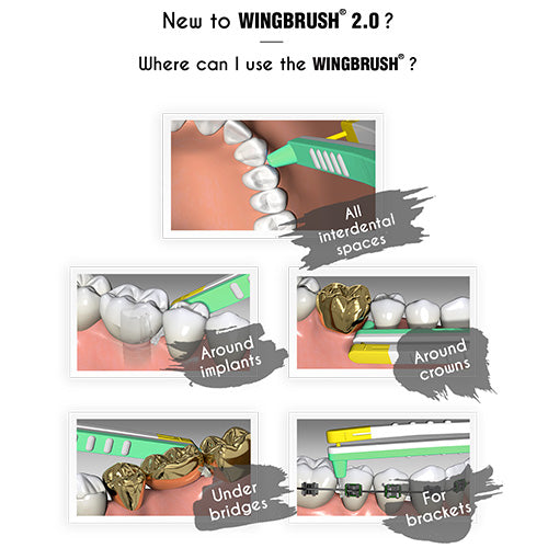 WINGBRUSH® Starter Set - Smart Interdental Brush